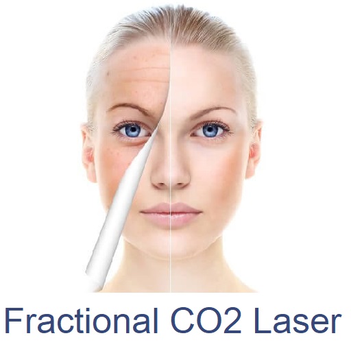 Fractional CO2 Laser