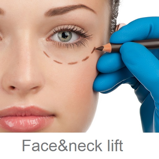 Face lift procedure